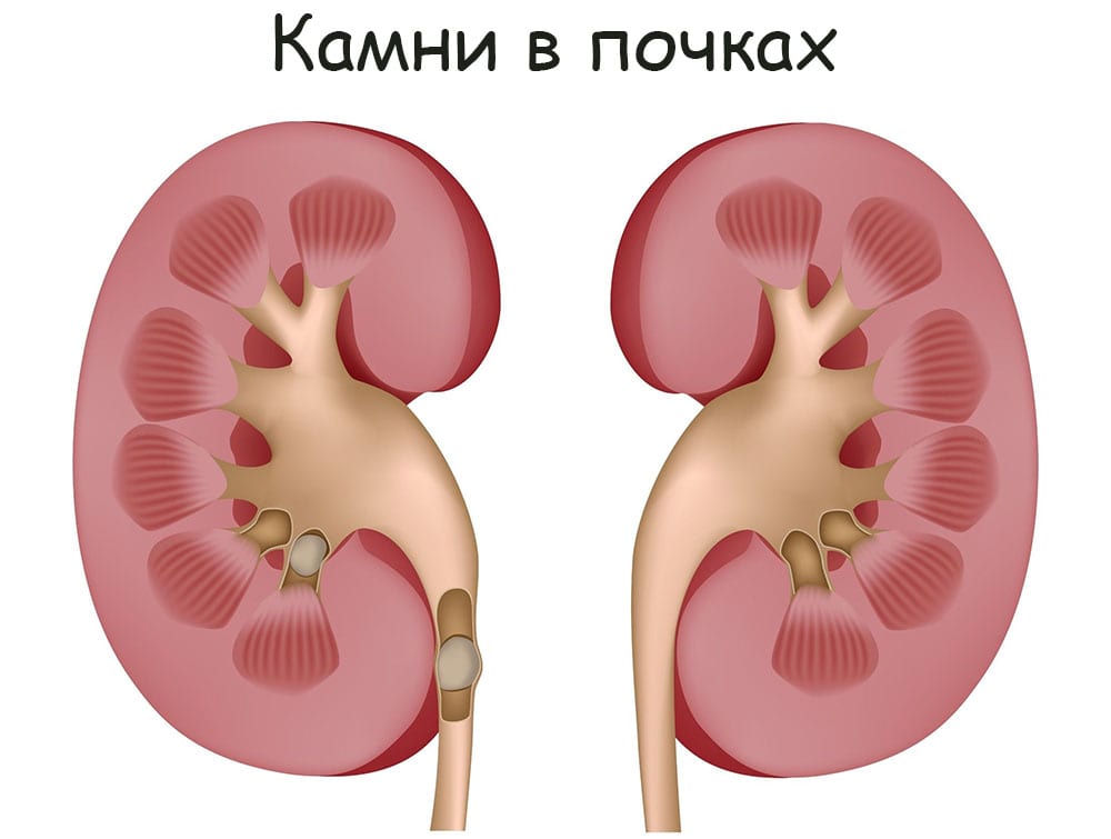 Ссылки мега кракен